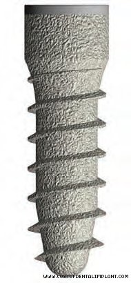 Tixos Cylindrical Implants - Internal Hex